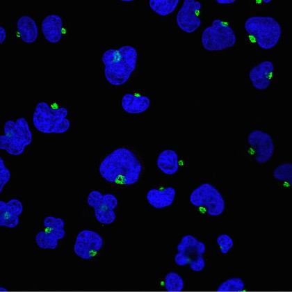Human T cells showing nuclei & Golgi bodies