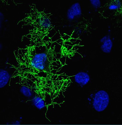 Staurosporine disrupts neutrophil membranes