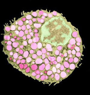 view Mast cell showing histamine granules