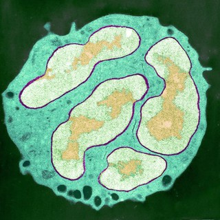 White blood cell - polymorphonuclear leucocyte - neutrophil