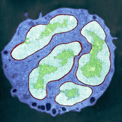 White blood cell - polymorphonuclear leucocyte