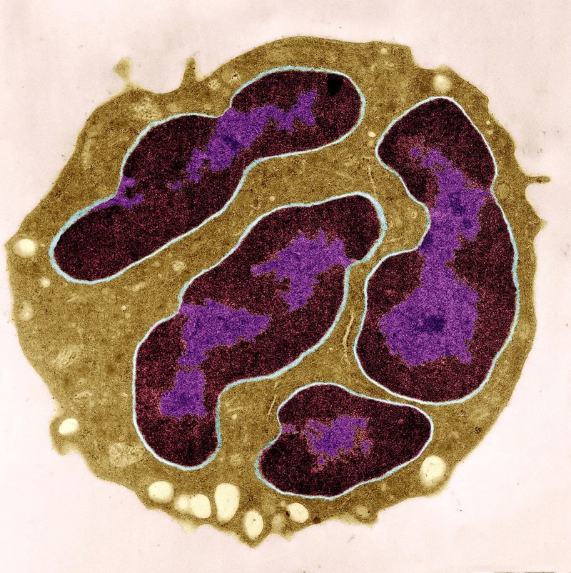 Микробиология цитология. Polymorphonuclear Cells. Polymorphonuclear neutrophils. Leucocyte Barotrauma.