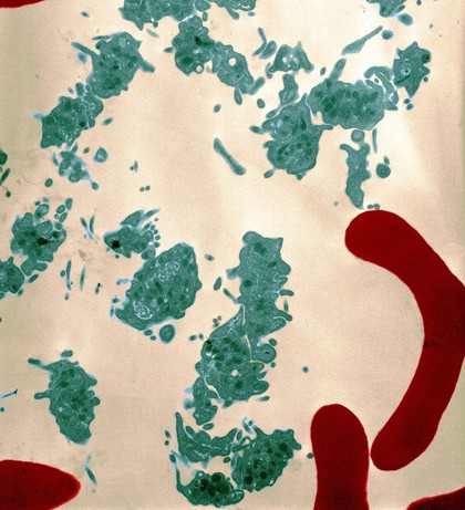 Platelets and red blood cells