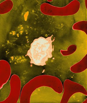 view Lymphocyte with red blood cells