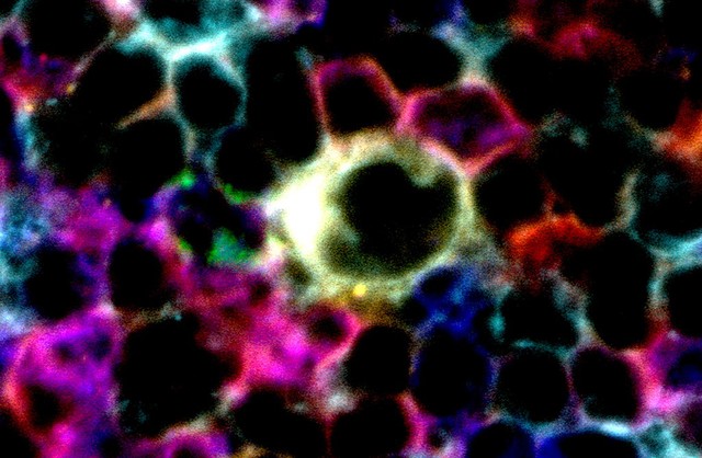 Cells interacting to cause immune response