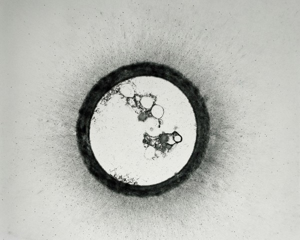 Cryptococcus cyst from a brain biopsy