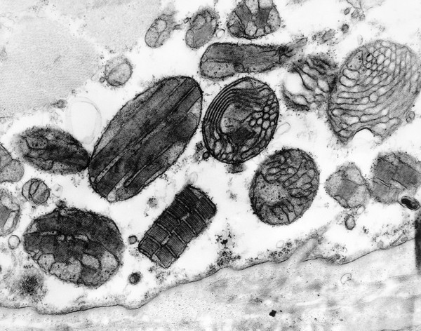 Mitochondria with crystalline inclusions