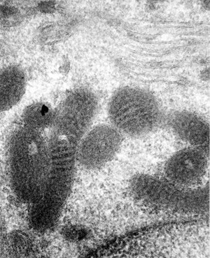 view TEM - mitochondria, nucleus and membranes