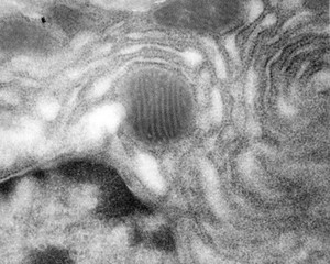 view TEM - mitochondria, nucleus and rough ER