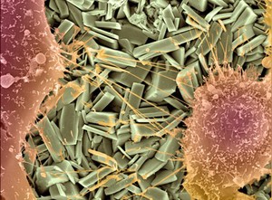 view Cells crawling across ceramic crystals