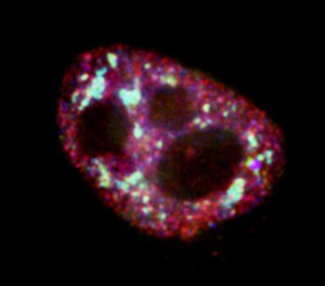 view Cell nucleus showing interchromatin granule clusters