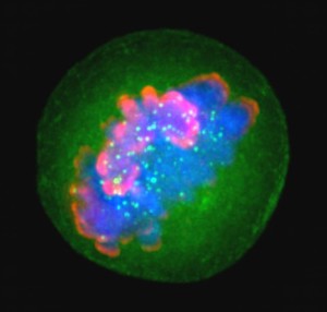 view Human chromosomes, histones and kinetochores