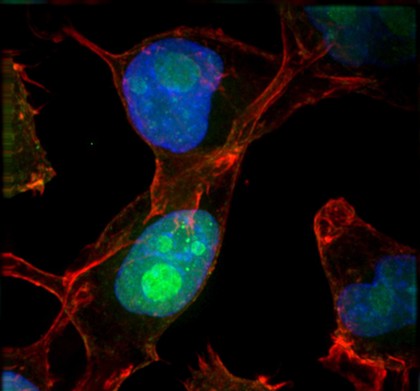 HeLa cells showing nuclei and nucleoli