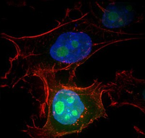 view HeLa cells showing nuclei and nucleoli