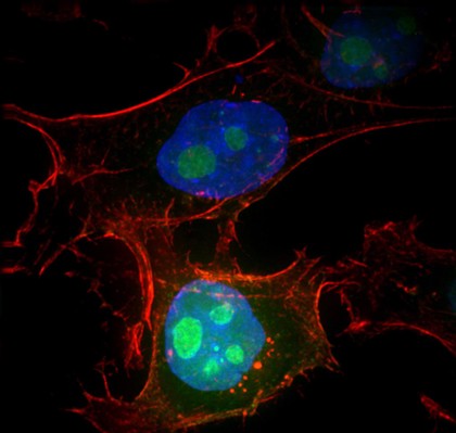 HeLa cells showing nuclei and nucleoli