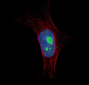 view HeLa cell showing nuclei and nucleoli