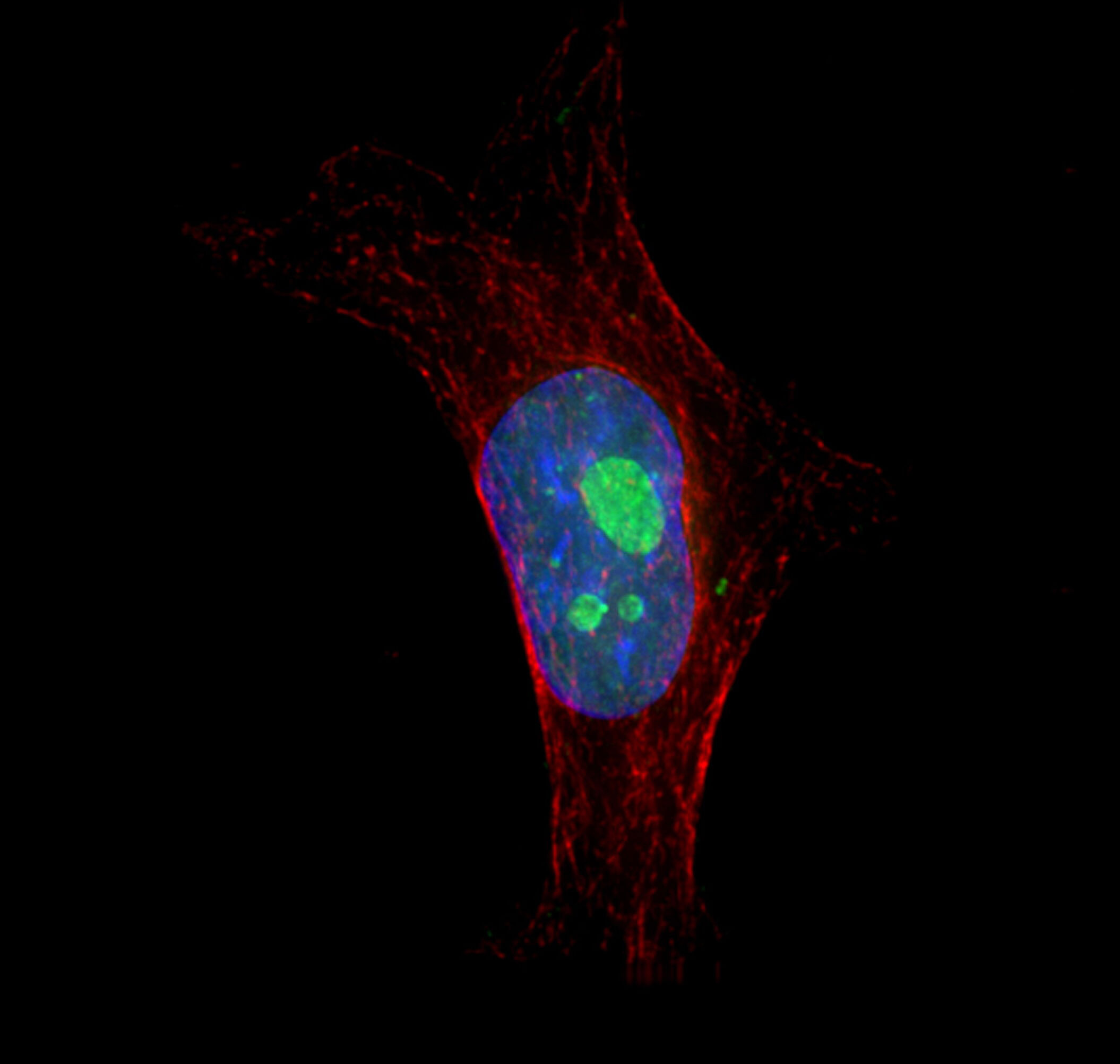 HeLa cell showing nuclei and nucleoli | Wellcome Collection