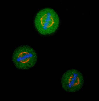HeLa cells in metaphase