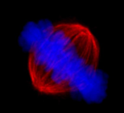 Chromosomes and spindle at metaphase