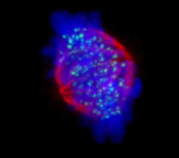 Human chromosomes and spindle at metaphase
