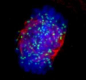 view Human chromosomes and spindle at metaphase