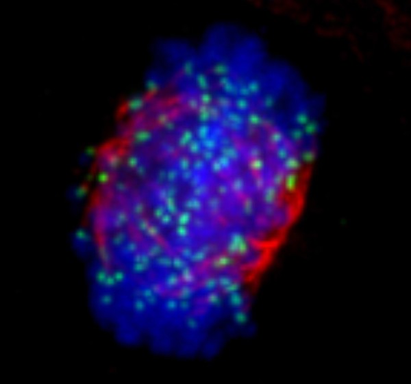 Human chromosomes and spindle at metaphase