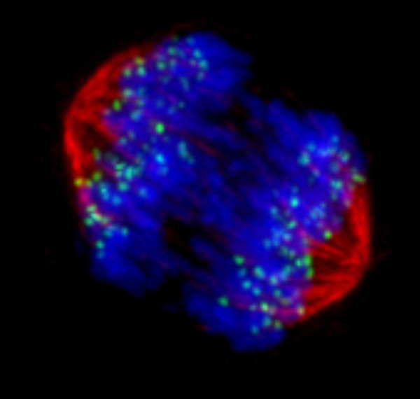 Human chromosomes and spindle at anaphase