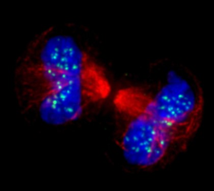 Human chromosomes and spindle at anaphase