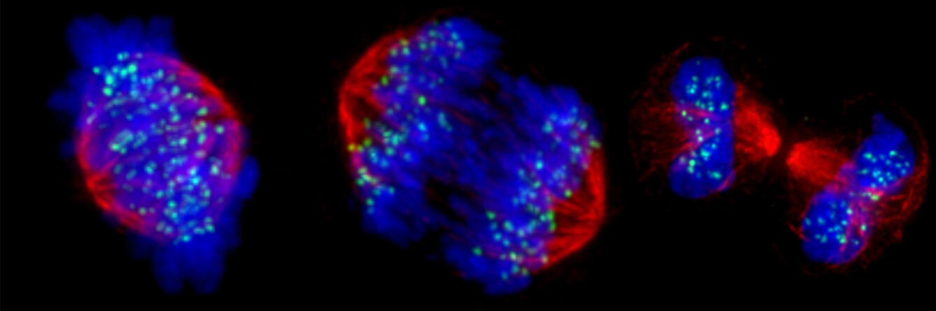 Human chromosomes at three stages of mitosis