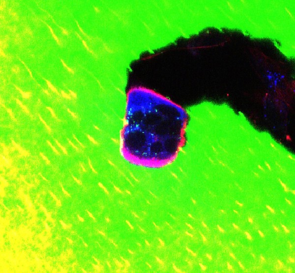 Osteoclast resorbing bone