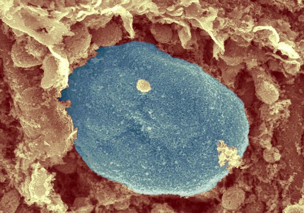 Surface view of a cell nucleus