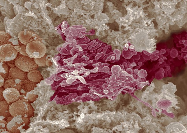 Golgi complex and mitochondria