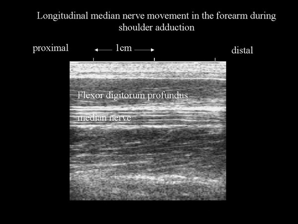 Nerve movement in forearm, ultrasound, shoulder adduction