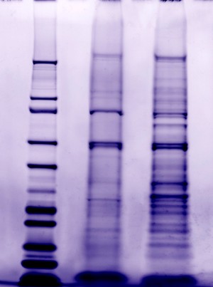 view Separating proteins by electrophoresis