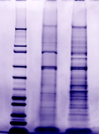 Separating proteins by electrophoresis