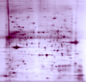 view Separating proteins by 2-dimensional gel electrophoresis