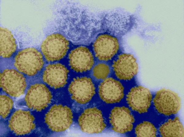 Reovirus particles