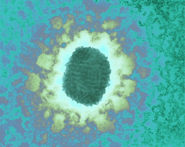 Molluscum virus