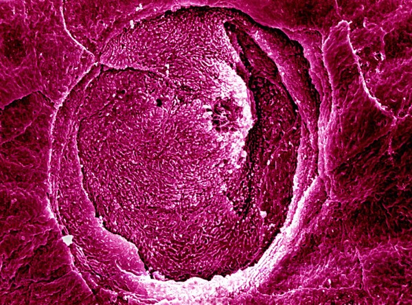 SEM Taste bud on fungiform papilla, close-up