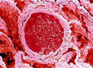view Blood vessel in lung