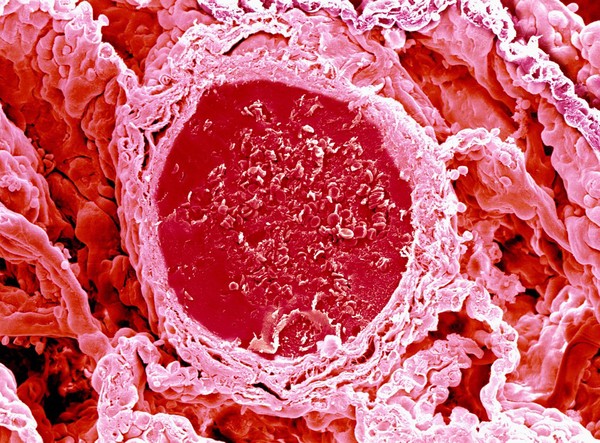 Blood vessel in lung