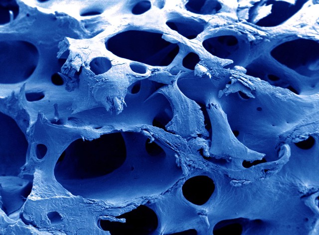 Normal bone, SEM