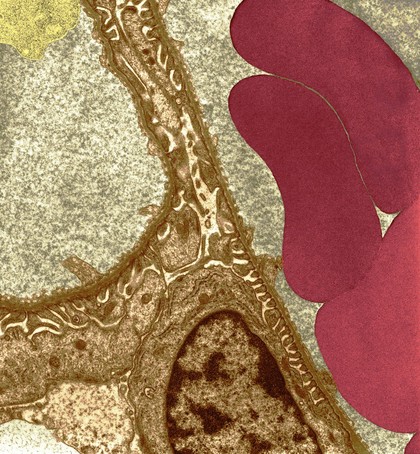 Glomerular capillaries and podocyte