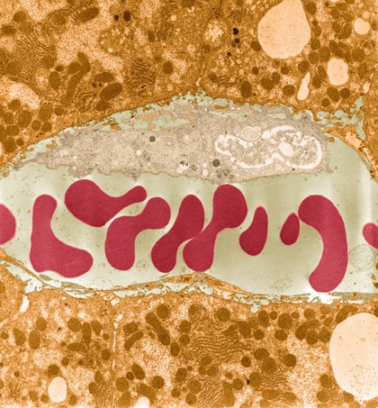 Blood vessel with red and white blood cells