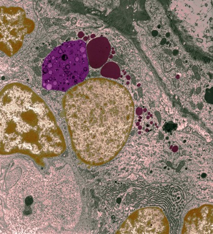 Macrophage with phagocytic vesicle and lysosomes