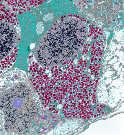 Growth hormone producing cell from the pituitary gland