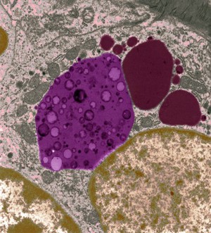 view Phagocytic vesicle and lysosomes inside a macrophage