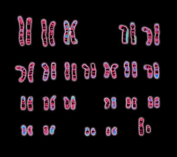 Normal male 46,XY human karyotype
