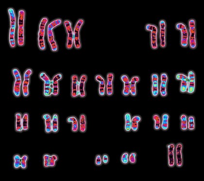 Normal female 46,XX human karyotype