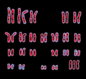 view Triple-X chromosome aberration karyotype